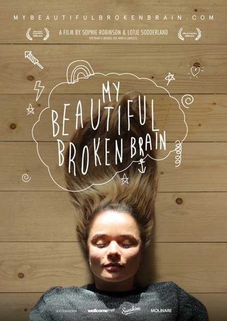 My Beautiful Broken Brain movie poster